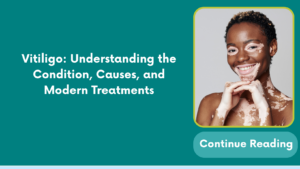 Vitiligo: Understanding the Condition, Causes, and Modern Treatments