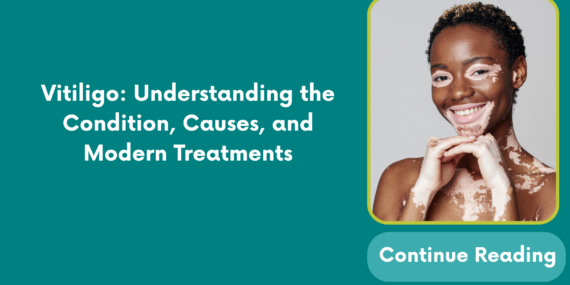 Vitiligo: Understanding the Condition, Causes, and Modern Treatments